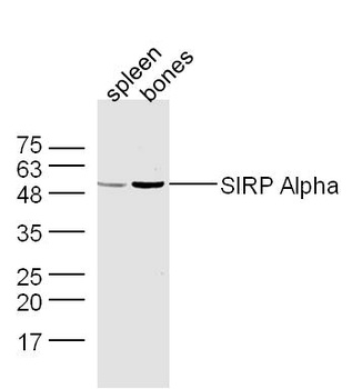 SIRP Alpha antibody