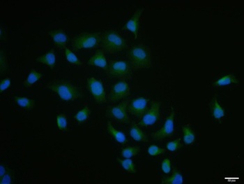 Cdc6 (phospho-Ser54) antibody