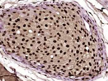 Phospho-CK18 (Ser60) Rabbit Polyclonal Antibody