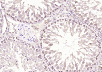 Phospho-CREM (Ser271 + Ser274) Rabbit Polyclonal Antibody