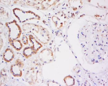 SMN1 Rabbit Polyclonal Antibody