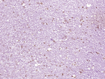 Histone H3 (tri methyl K9) Mouse Monoclonal Antibody