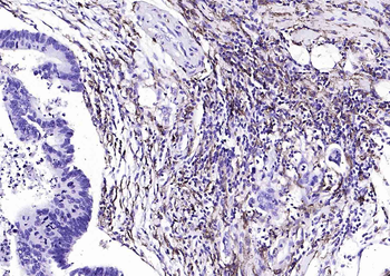 CD14 Rabbit Polyclonal Antibody
