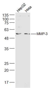 MMP3 Rabbit Polyclonal Antibody