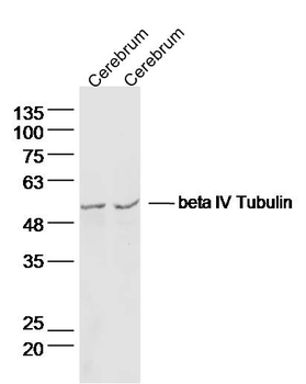 Beta IV Tubulin Rabbit Polyclonal Antibody