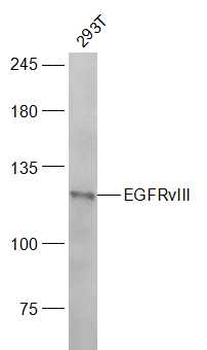 EGFRvIII Rabbit Polyclonal Antibody