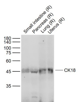 CK18 antibody