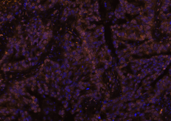 C-Maf Rabbit Polyclonal Antibody