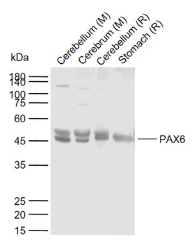 PAX6 Rabbit Polyclonal Antibody