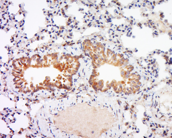 SLC34A1 Rabbit Polyclonal Antibody