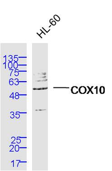 COX10 Rabbit Polyclonal Antibody