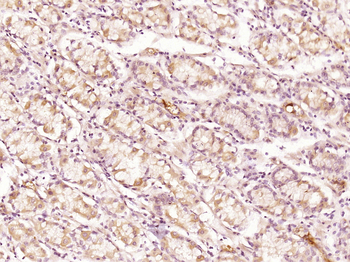 CCL27 Rabbit Polyclonal Antibody
