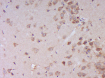 BRCA1 Rabbit Polyclonal Antibody