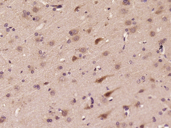 ASB5 Rabbit Polyclonal Antibody