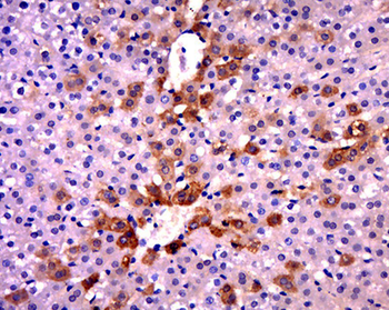 SOD2 Rabbit Polyclonal Antibody