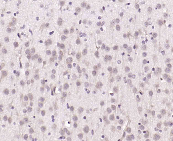 NUCB2 Rabbit Polyclonal Antibody