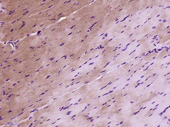 SOCS3 Rabbit Polyclonal Antibody