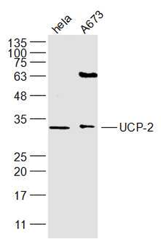 UCP-2 Rabbit Polyclonal Antibody