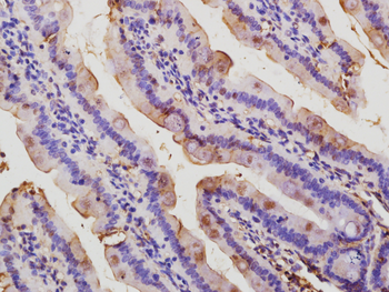 Beta catenin Rabbit Polyclonal Antibody