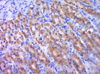 LDLR Rabbit Polyclonal Antibody