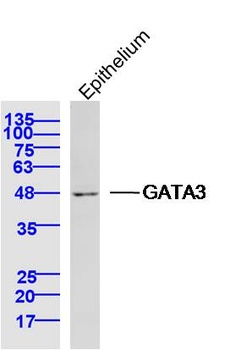 GATA3 antibody
