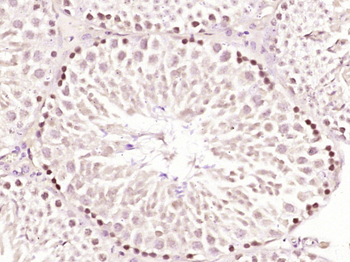 TBX22 Rabbit Polyclonal Antibody