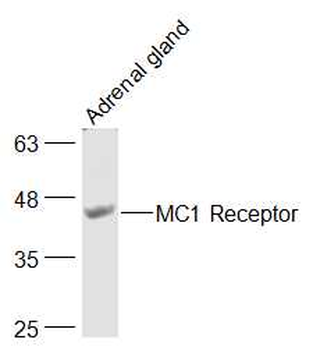 MC1R Rabbit Polyclonal Antibody