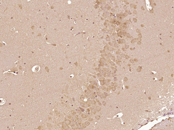 Neurochondrin Rabbit Polyclonal Antibody