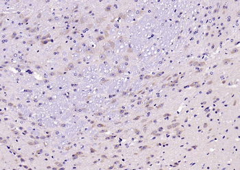 SOD2 Rabbit Polyclonal Antibody