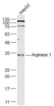Arginase 1 Rabbit Polyclonal Antibody