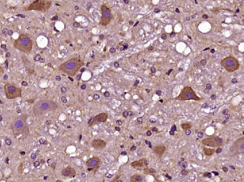 ERC1 Rabbit Polyclonal Antibody