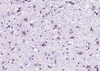 GLRB Rabbit Polyclonal Antibody