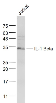 IL-1 Beta Rabbit Polyclonal Antibody