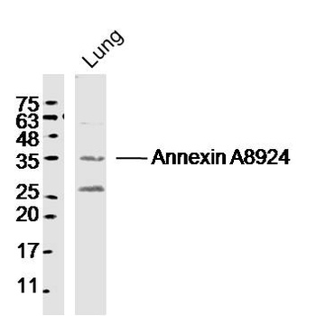Annexin A8 Rabbit Polyclonal Antibody