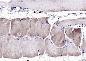 GDF8 Rabbit Polyclonal Antibody