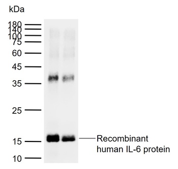 Human IL-6 antibody