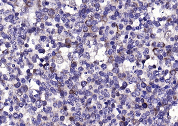 CD63 Rabbit Polyclonal Antibody