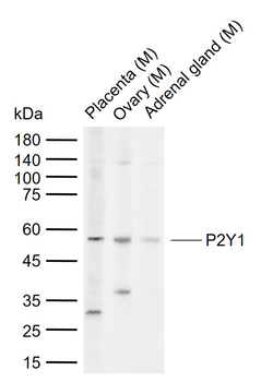 P2Y1 Rabbit Polyclonal Antibody