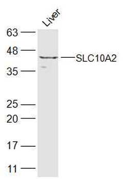 SLC10A2 Rabbit Polyclonal Antibody