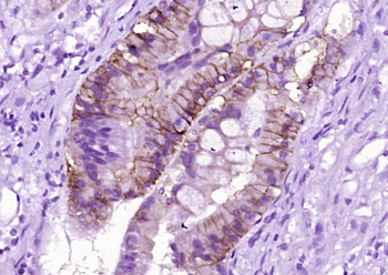 CA9 Mouse Monoclonal Antibody