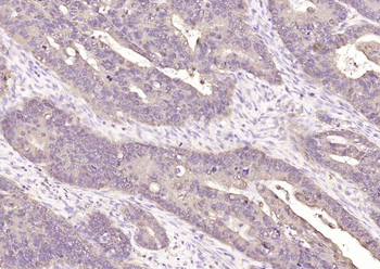 Bcl-2 Mouse Monoclonal Antibody