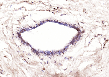 Bcl-2 Mouse Monoclonal Antibody