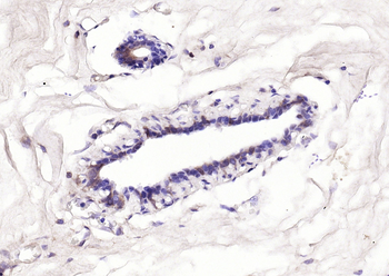 Bcl-2 Mouse Monoclonal Antibody