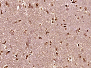 PKC Epsilon Rabbit Polyclonal Antibody