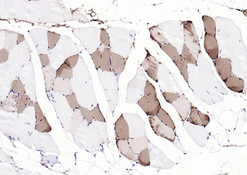 Myoglobin Mouse Monoclonal Antibody