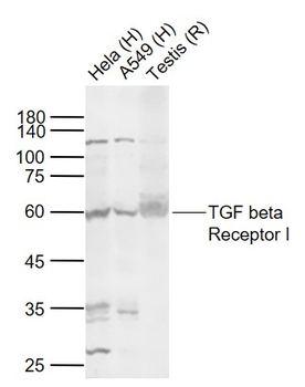 TGF beta Receptor I Rabbit Polyclonal Antibody