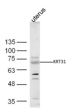 KRT31 Rabbit Polyclonal Antibody