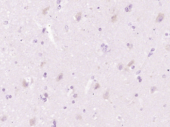 CH25H Rabbit Polyclonal Antibody