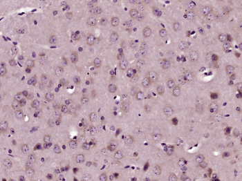 RBM33 Rabbit Polyclonal Antibody
