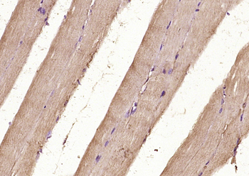 Muscle Actin Rabbit Polyclonal Antibody